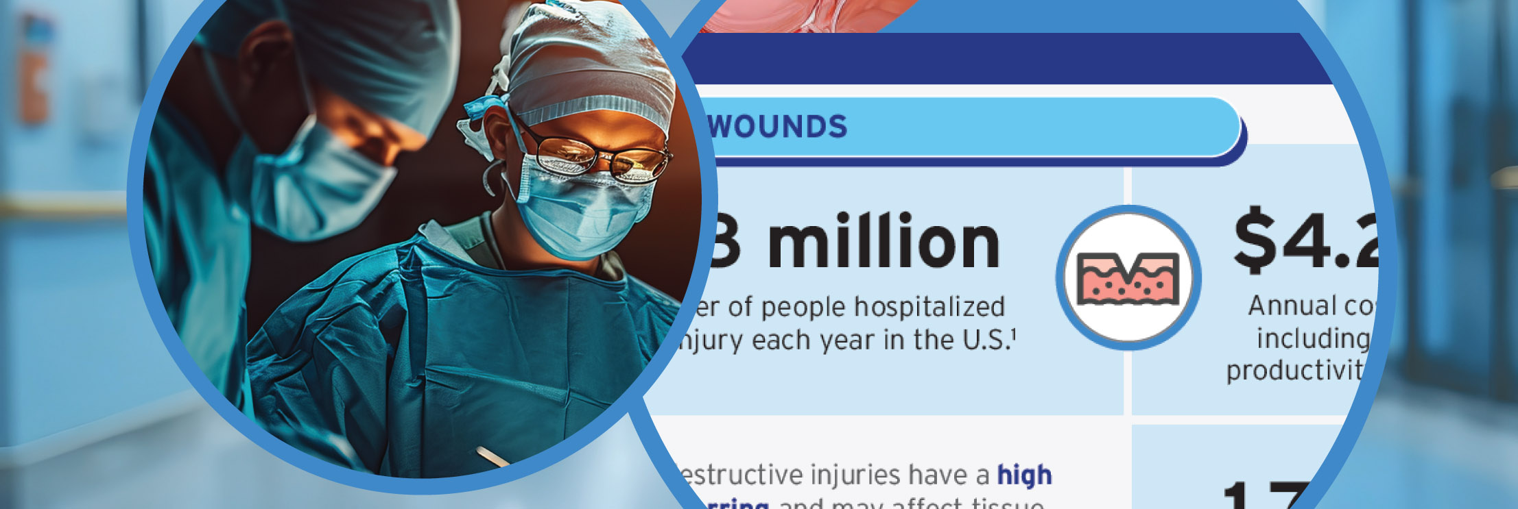 infographic expedited wound healing burn care surgical trauma