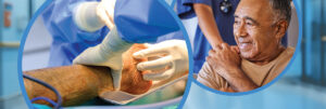 Achieving closure lower extremity wounds