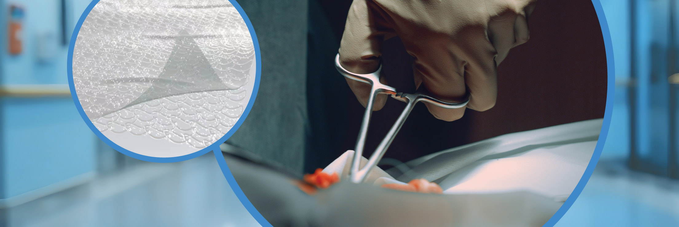 Biosynthetic wound matrix - strategic wound closure - permeaderm