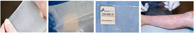 biosynthetic wound matrix stretch placement joint flexible