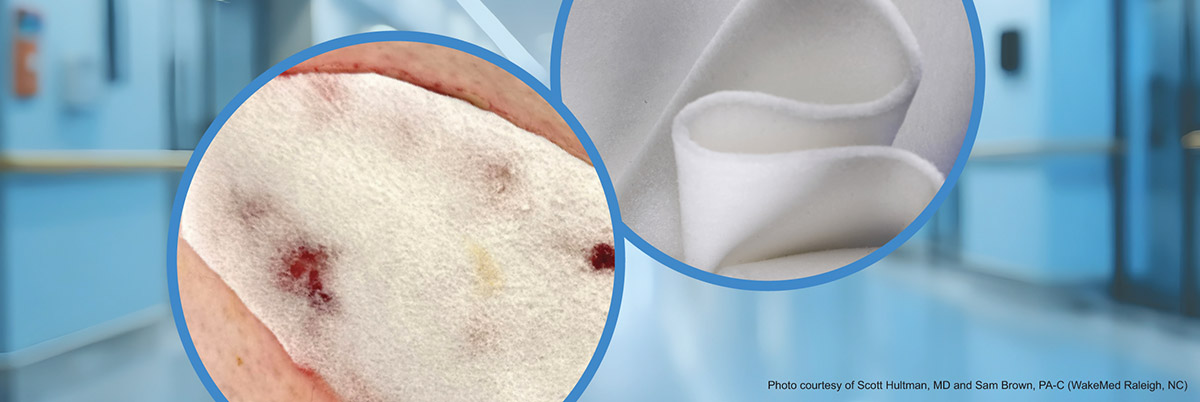 collagen dermal matrix acute wound revascularize cohealyx