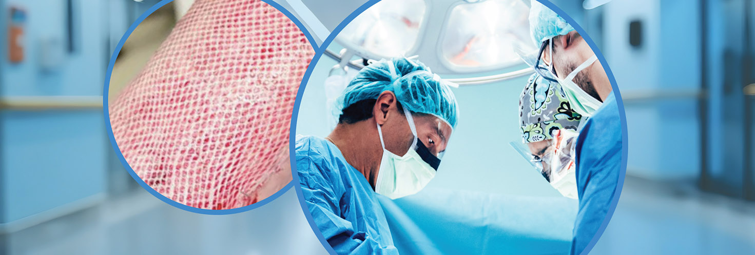 autologous cell therapy recell spray-on skin cells reconstructive surgery trauma wound