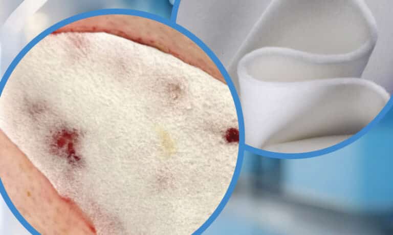 Dermal Matrices: What Features Matter Most For Time To Graft?