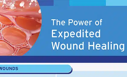 Infographic: The Power of Expedited Wound Healing in Burn, Trauma, and Reconstructive Care